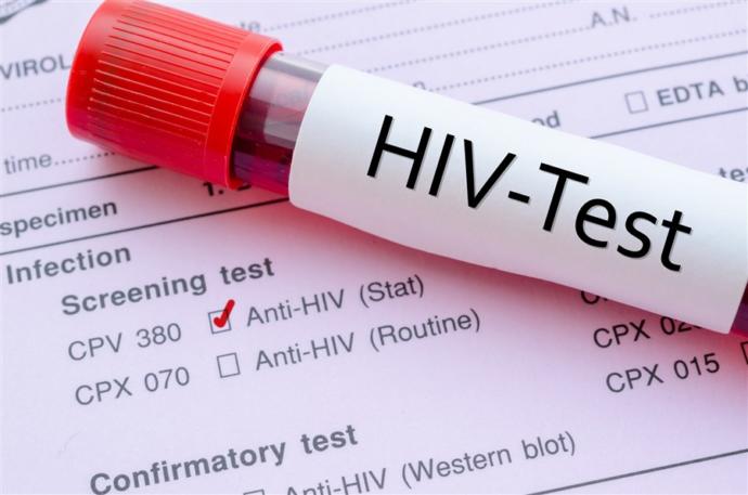 HIV (Human Immunodeficiency Virus) İle İlgili Bilinmesi Gerekenler!