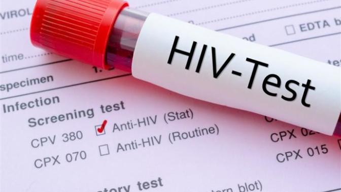 HIV (Human Immunodeficiency Virus) İle İlgili Bilinmesi Gerekenler!