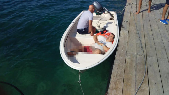 Bodrum'da Magazin Gazetecilerini Taşıyan Tekne Batırıldı! Kaptanın Bacağı Koptu