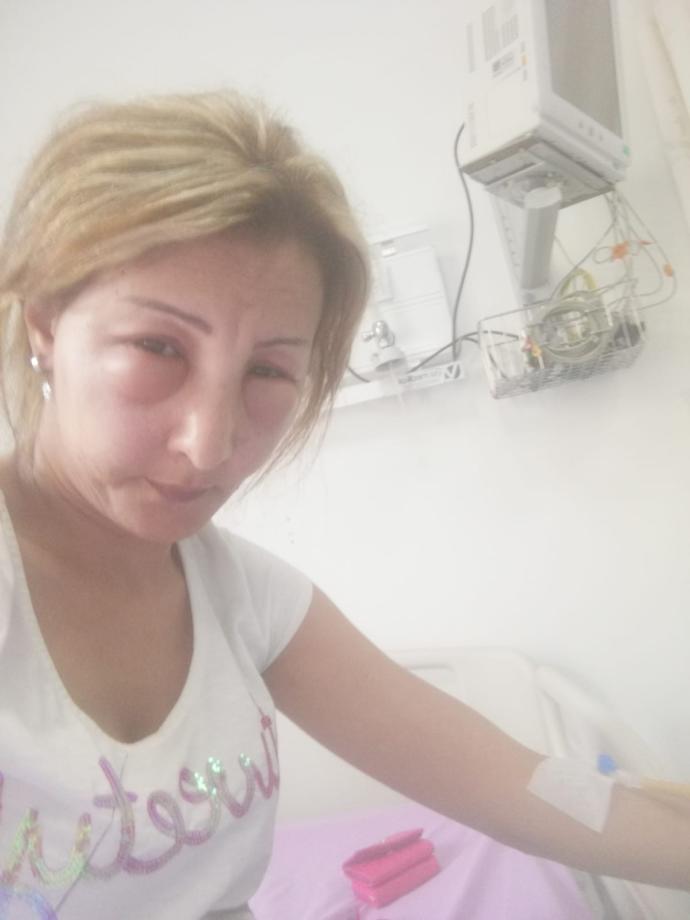 Saçları 7 Saat Boyalı Kalan Kadın Az Daha Ölüyordu!
