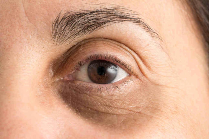 Vücudumuzun Vitamin Eksikliği Yaşadığını Haber Veren 5 İşaret