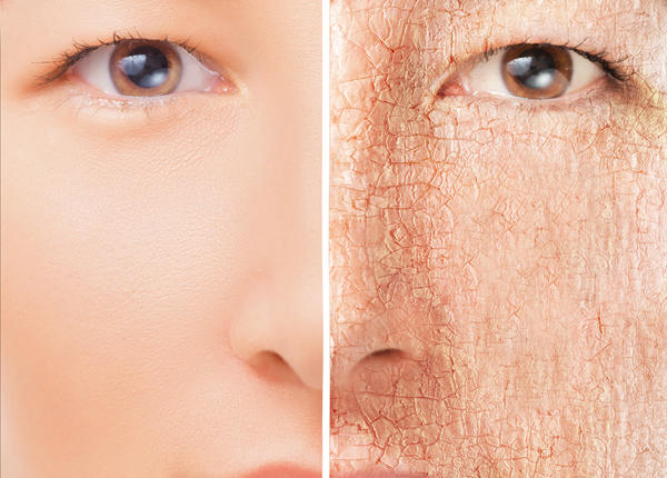 Vücudumuzun Vitamin Eksikliği Yaşadığını Haber Veren 5 İşaret