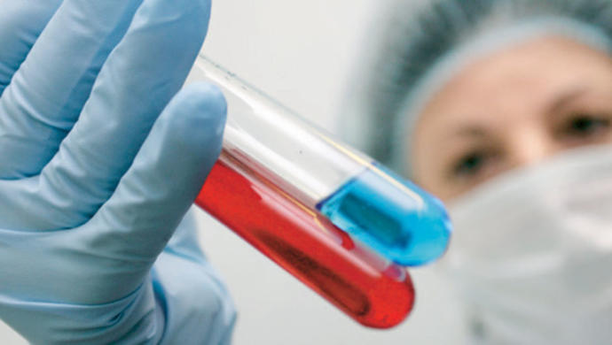 AIDS Hakkında Bilmeniz Gerekenler