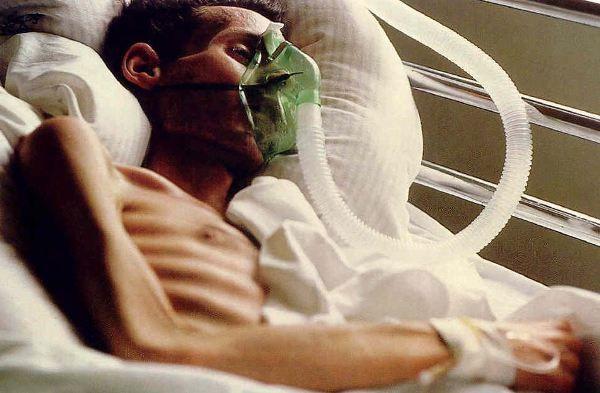 AIDS Hakkında Bilmeniz Gerekenler
