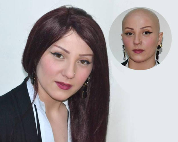 Protez Saç Hakkında Merak Edilen Her Şey!