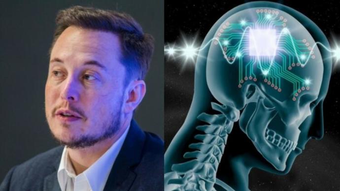Elon Musk'ın Bir Girişimi Olan Neuralink Projesi Nedir?