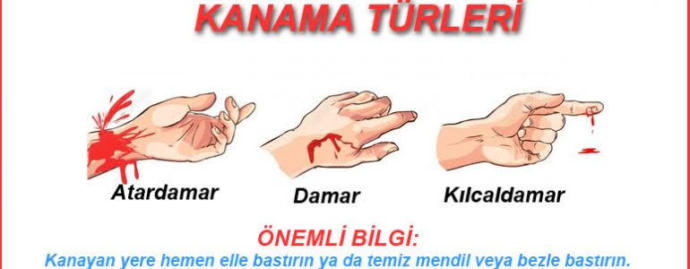Kanama türleri ve müdahale
