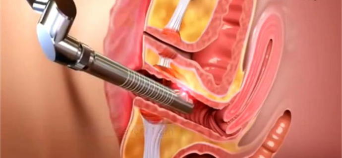 Kızlık Zarı ile İlgili Merak Edilen Sorular Nelerdir?