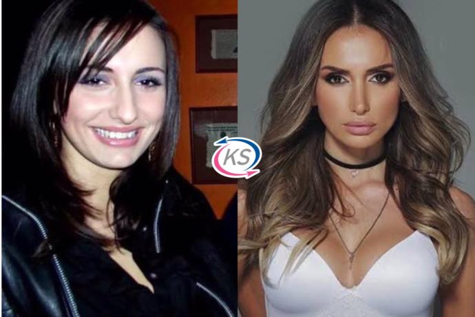 Evrimin Bir Tık Altı: Ünlülerin Gelmiş Geçmiş En Mucizevi Burun Ameliyatları!