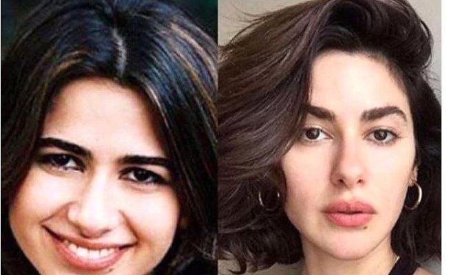 Evrimin Bir Tık Altı: Ünlülerin Gelmiş Geçmiş En Mucizevi Burun Ameliyatları!