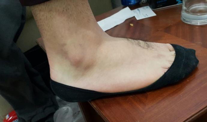Sonbaharın Gelmesiyle, Artık Seni Gözüm Görmesin Dediğimiz Yaz Giysileri