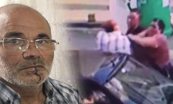 Dudağından Yaralanan Kayınpeder
