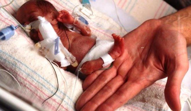 Şaşırtıcı ama Gerçek: Dünyanın En İlginç Anneleri