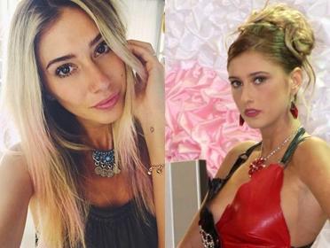 O Eski Hallerinden Eser Yok Şimdi: Estetik İle Adeta Başka Birine Dönüşen Ünlüler!