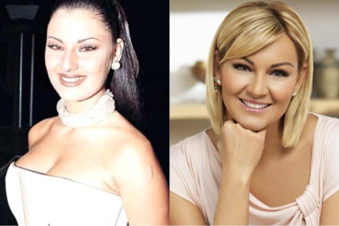 O Eski Hallerinden Eser Yok Şimdi: Estetik İle Adeta Başka Birine Dönüşen Ünlüler!