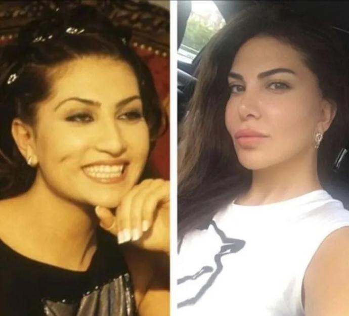 O Eski Hallerinden Eser Yok Şimdi: Estetik İle Adeta Başka Birine Dönüşen Ünlüler!