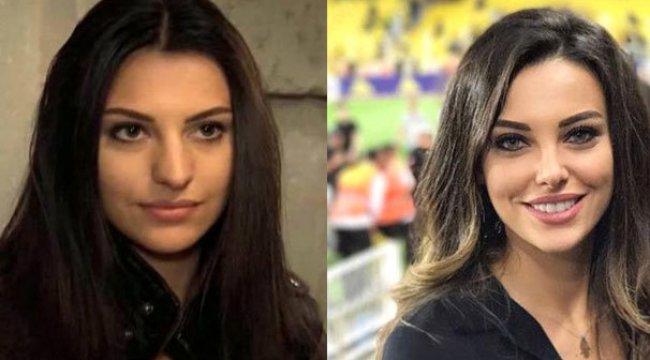 O Eski Hallerinden Eser Yok Şimdi: Estetik İle Adeta Başka Birine Dönüşen Ünlüler!