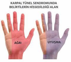 Çağdaş Ellerin Hastalığı