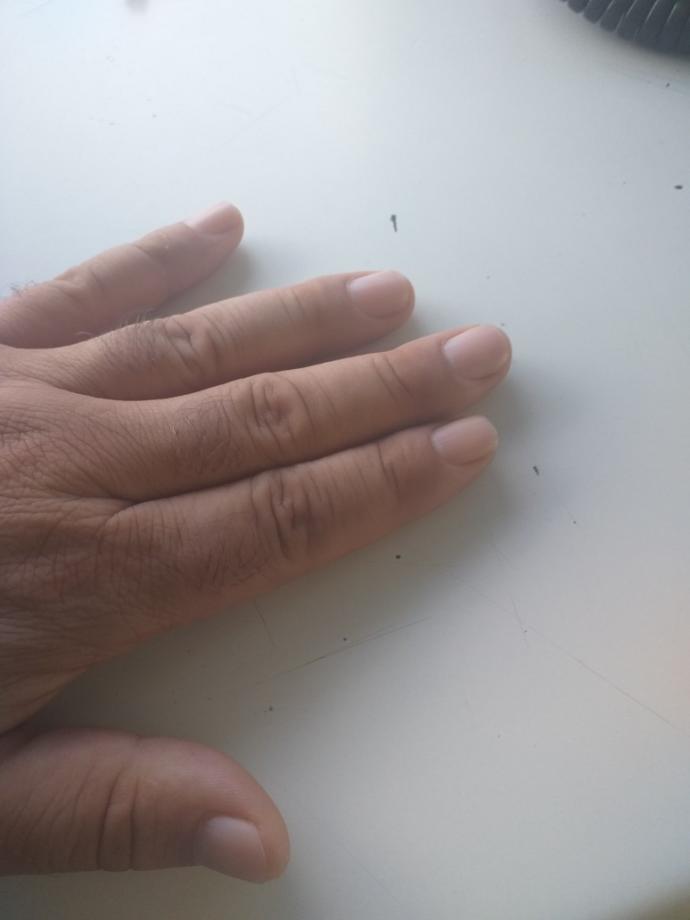 Ellerin Bakımsız ve Çirkin Görünmesine Sebep Olan Tırnak Yeme Alışkanlığını Bırakmanız İçin Öneriler