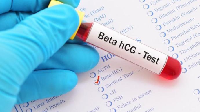 Nedir Bu HCG? Kanda Gebelik Testi İle İlgili Her Şey!