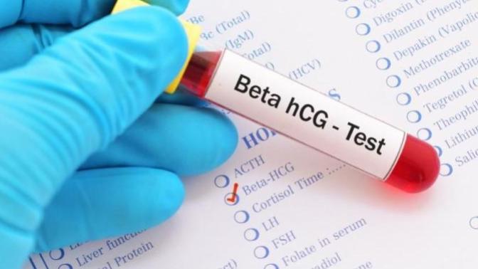 Nedir Bu HCG? Kanda Gebelik Testi İle İlgili Her Şey!