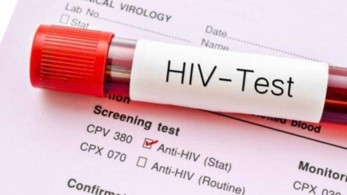 1 Aralık Dünya HIV/AIDS Günü ve AIDSten Korunma Yöntemleri!