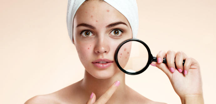 Varlığı Bir Dert Yokluğu Yara: Sebum Hakkında Her Şey!