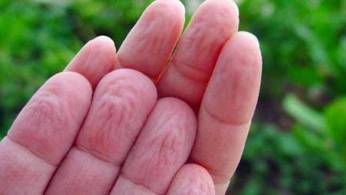 Varlığı Bir Dert Yokluğu Yara: Sebum Hakkında Her Şey!