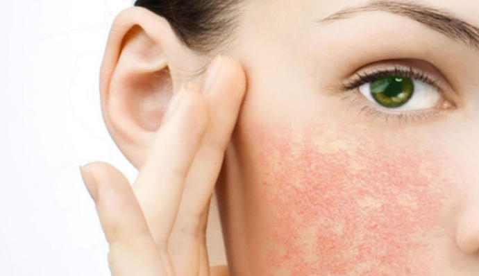 Varlığı Bir Dert Yokluğu Yara: Sebum Hakkında Her Şey!