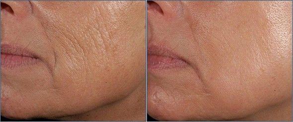 Anti Aging Ürünlerinizde Olması Gereken Takviyeler!