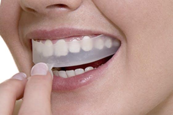Diş Beyazlatma Evde Nasıl Yapılır?