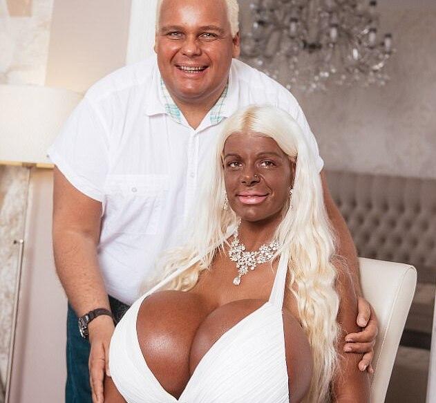 Barbieye Dönüşmek İçin Sayısız Estetik Operasyonu Geçiren 28 Yaşındaki Genç Model Martina Big!