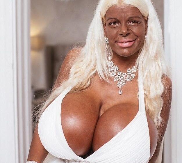 Barbieye Dönüşmek İçin Sayısız Estetik Operasyonu Geçiren 28 Yaşındaki Genç Model Martina Big!