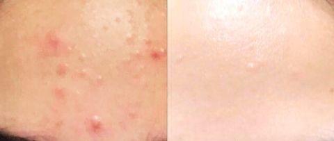Retinol Hakkında Gerçekler!