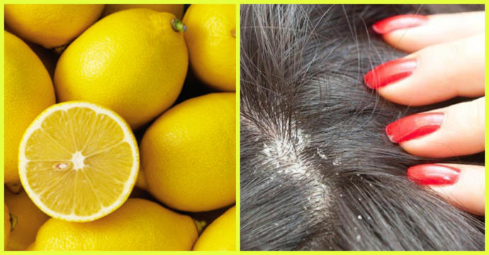 Saç Bakımının Olmazsa Olmazı: Limon Suyu