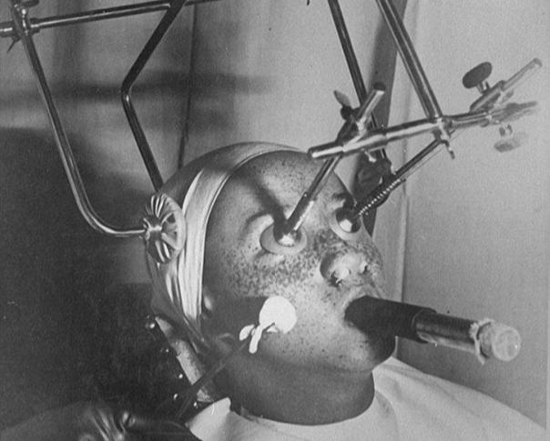 Ne Bileyim Bir İlginç! Diyeceğiniz 1930-40 Yılları Arasında Başvurulan İlginç Güzellik Yöntemleri!