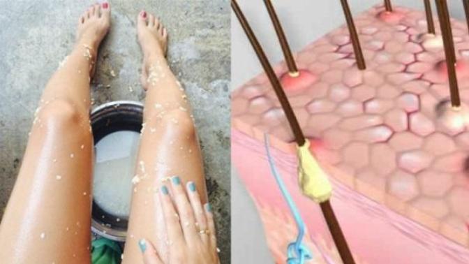 Keratosis Pilaris (Ciltte Tavuk Derisi Görünümü) Hakkında Her Şey