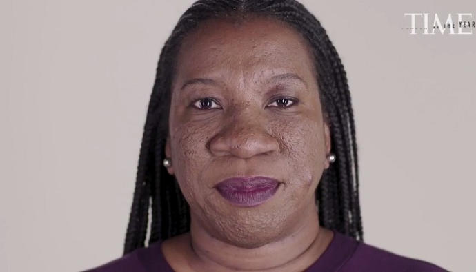 Tarana Burke. Bu kadını öpebileni Allah kolaylık versin