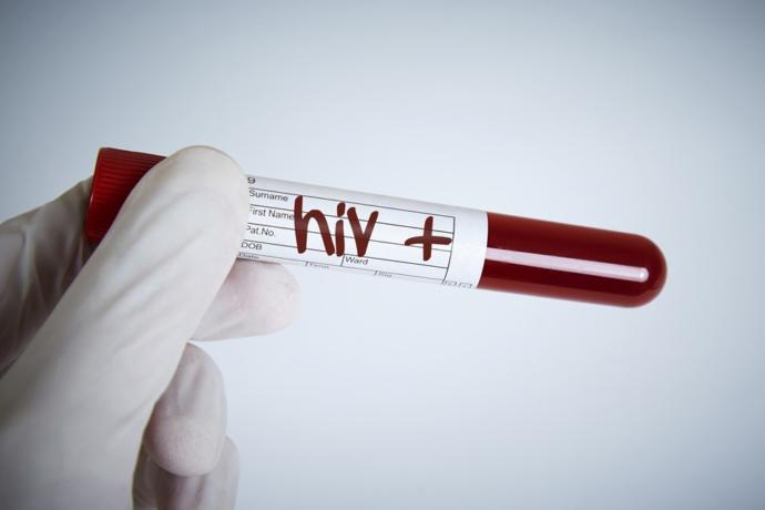 HIV dünyanın sonu değildir.