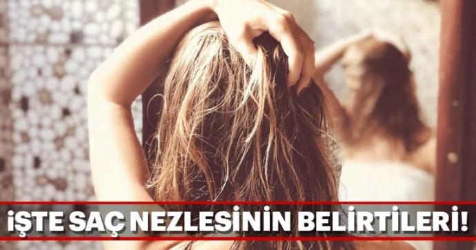Saç Nezlesinin Ne Olduğunu Biliyor muyuz?
