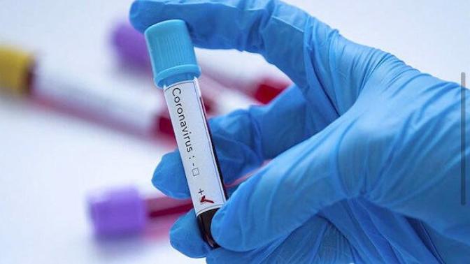 Online Koronavirüs Testi Yaptın mı?