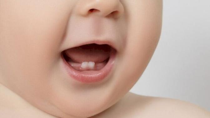 Bebek ve Çocuklarda Diş Çıkarma Sıralaması