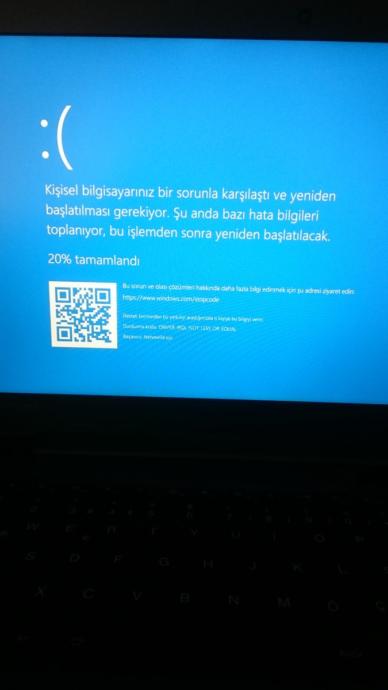 beyin yakan hata