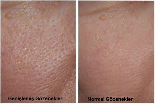 Evde Yapabileceğiniz Mükemmel Maskeler ❤