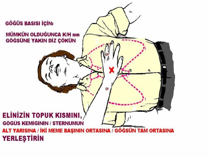 Temel İlk Yardım Uygulamalarını Biliyor Musunuz? İstenmeyen bir olay anında ne yapabilirsiniz?
