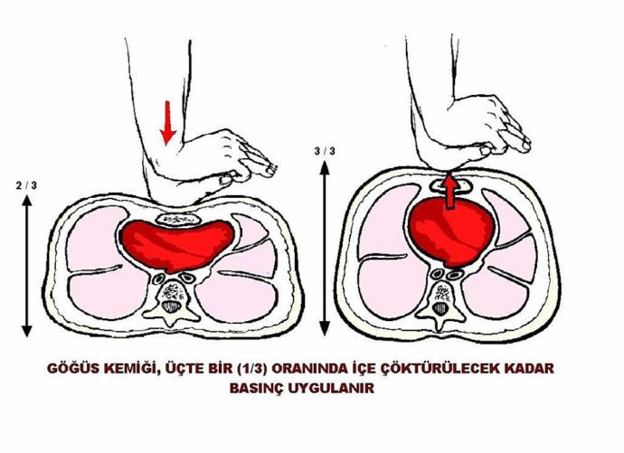 Temel İlk Yardım Uygulamalarını Biliyor Musunuz? İstenmeyen bir olay anında ne yapabilirsiniz?