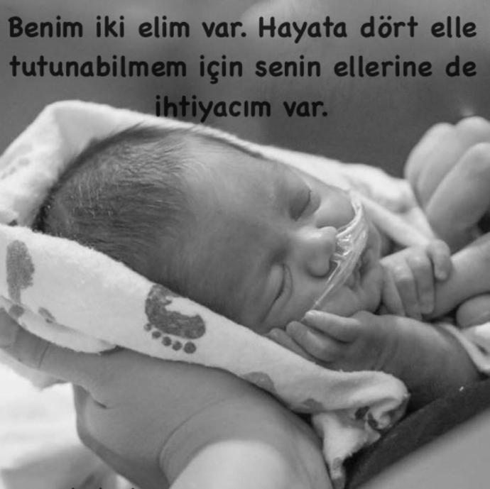 Benim İki Elim Var, Hayata Dört Elle Tutunabilmem İçin Senin Ellerine de İhtiyacım Var