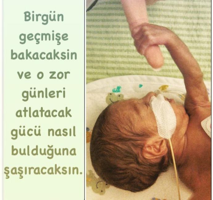 Benim İki Elim Var, Hayata Dört Elle Tutunabilmem İçin Senin Ellerine de İhtiyacım Var