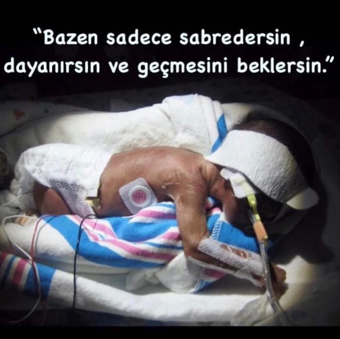 Benim İki Elim Var, Hayata Dört Elle Tutunabilmem İçin Senin Ellerine de İhtiyacım Var