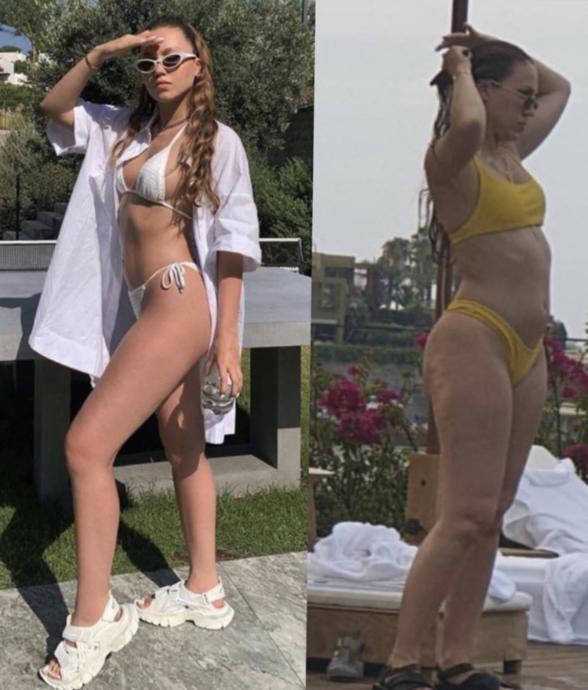 Kilolu Fotoğrafları Basına Sızan Duygu Özaslan Hastalığını Açıkladı